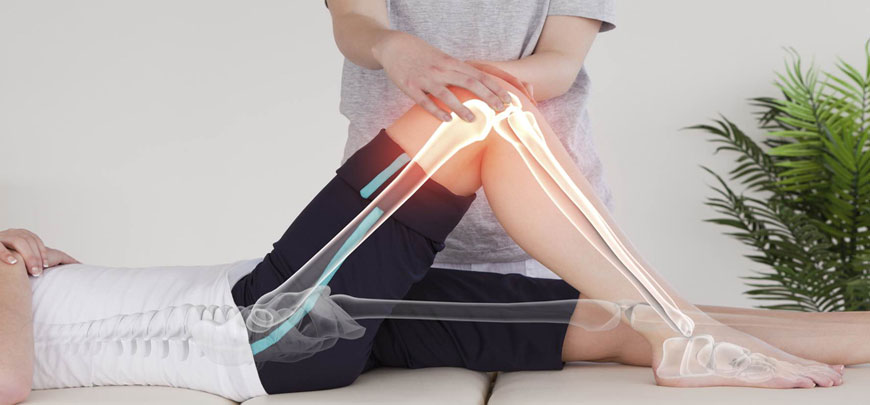 Knee Replacement